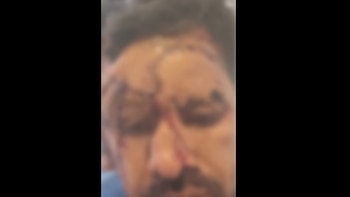 Víctima sufrió lesiones severas en el rostro y recibió más de 100 puntos. Captura de pantalla