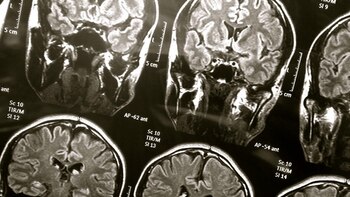 “Aún no se conoce evidencia