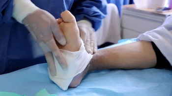 Pacientes con diabetes enfrentan alto riesgo de amputación si no mantienen un control adecuado de su enfermedad