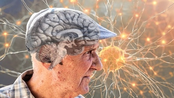 El cerebro de un ‘superanciano’