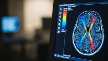 Cómo el cerebro logra moldear