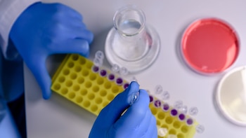 Bacterias en la orina, una fuente de testosterona: así es la relación entre el cáncer de próstata y el microbioma urinario