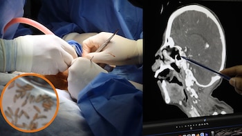 Paciente de 40 años de