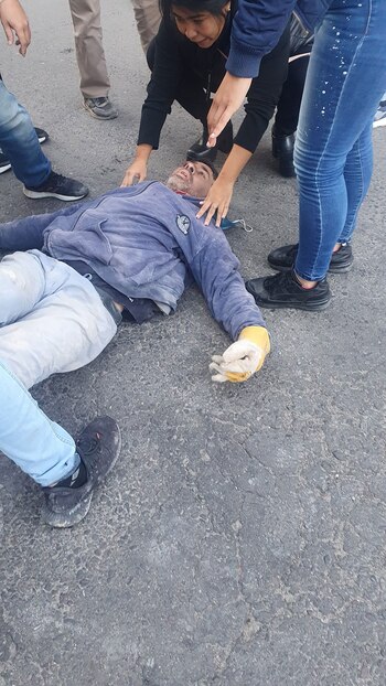 Uno de los obreros heridos