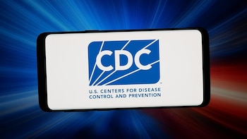 EEUU sigue de cerca más de 40 posibles contagios de hantavirus
