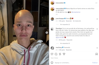 Manuela Viale sorprende con un cambio de look impactante para la película argentina 'Instante', donde interpreta a una paciente oncológica