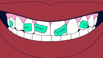 Una caries no siempre necesita empaste