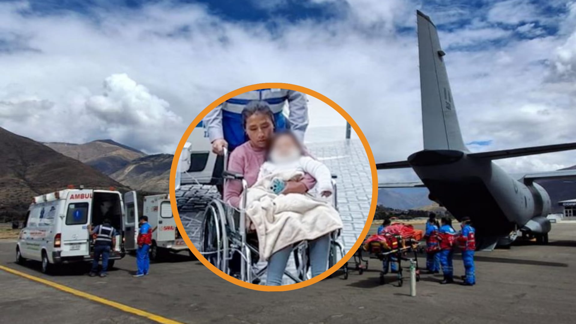 Bebé con quemaduras trasladado de emergencia a Lima