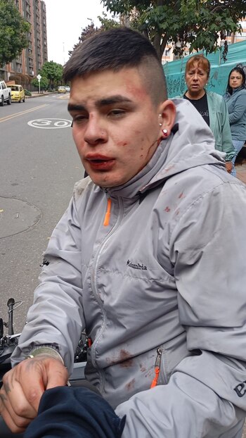 El presunto delincuente fue agredido