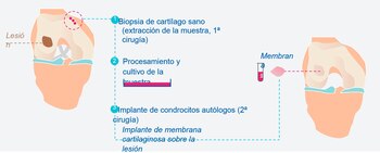 Un dibujo que explica como
