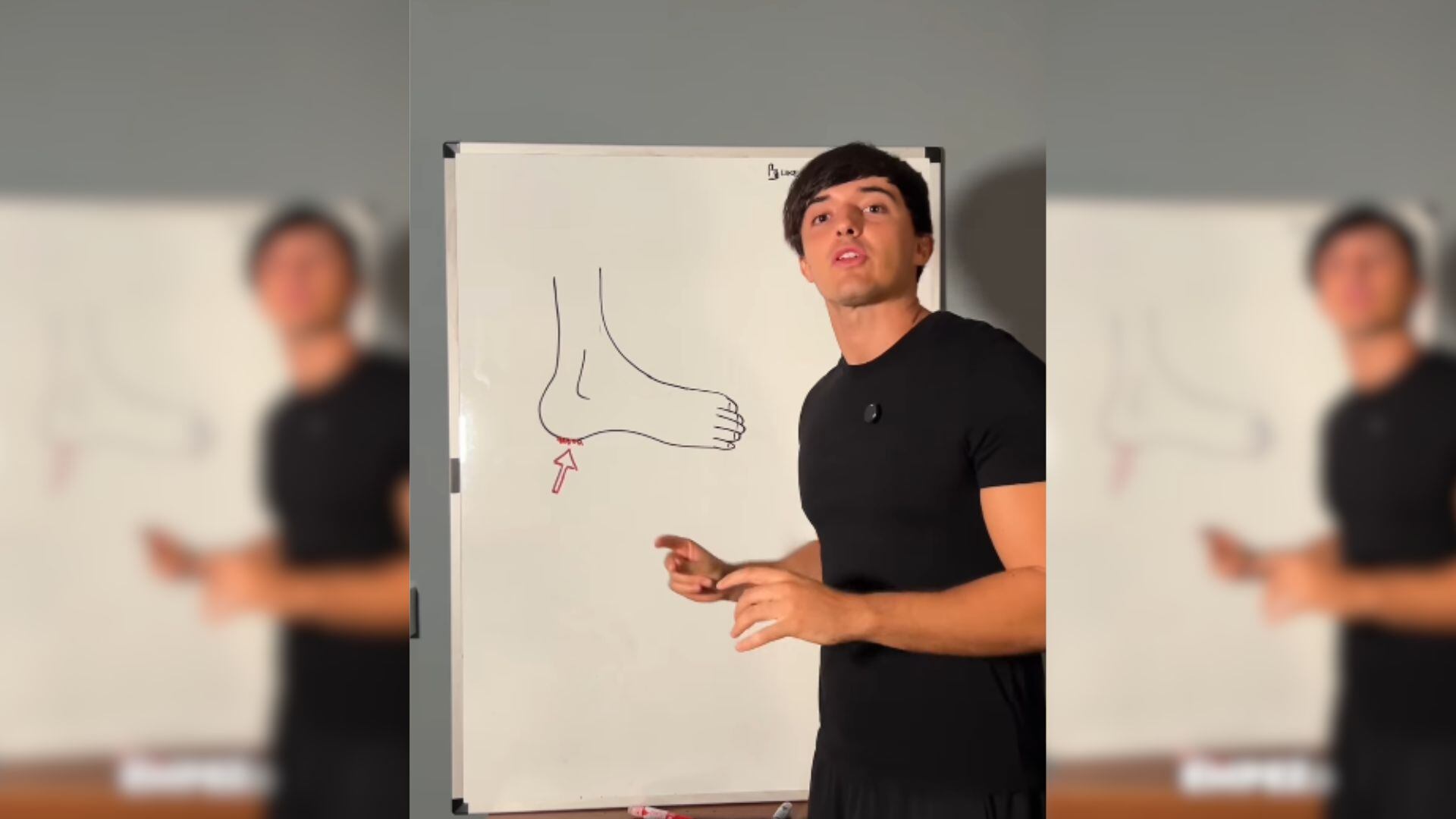 El fisioterapeuta Toni Pérez explica cómo ha sido el proceso de recuperación de su fascitis plantar (Montaje Infobae / @fisioteduca)