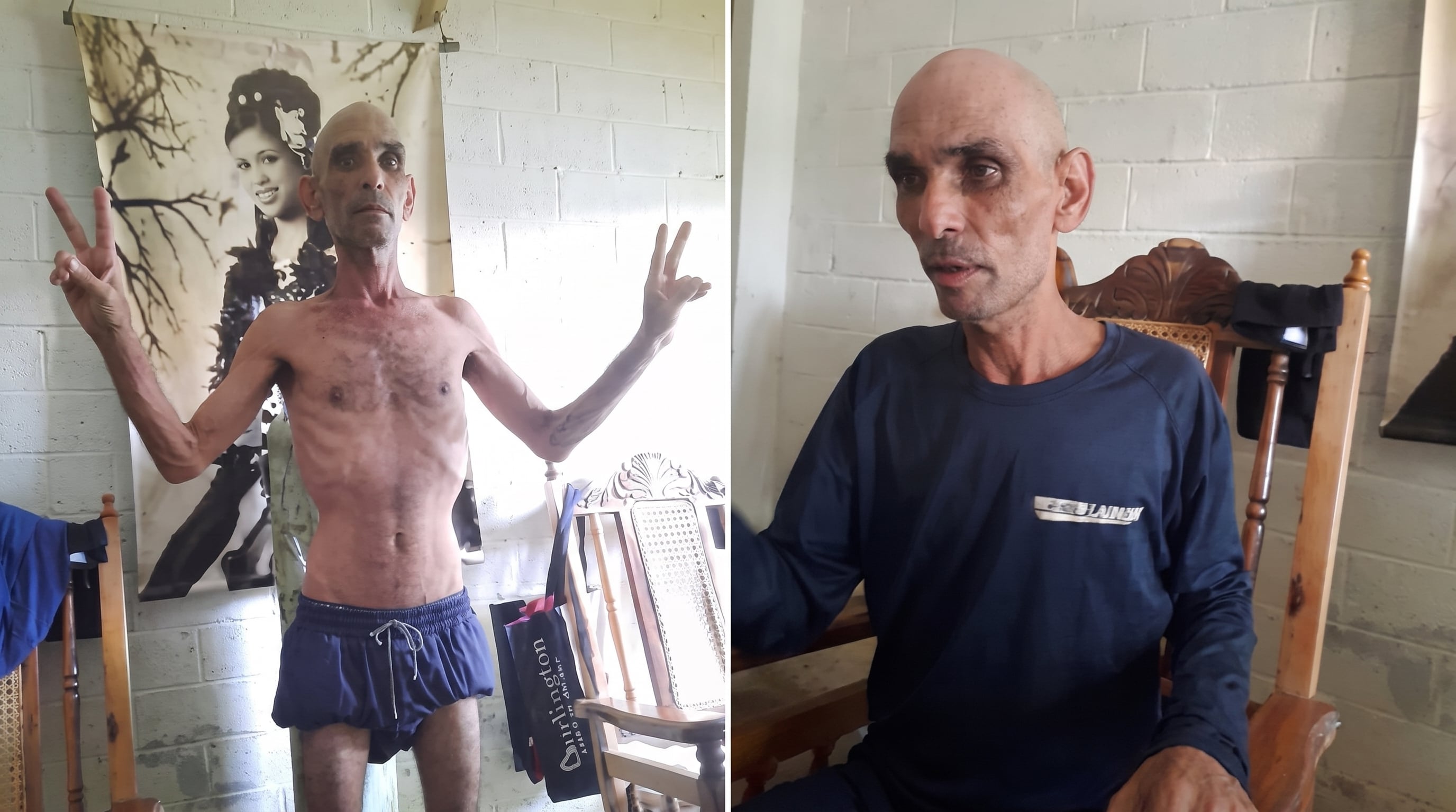 Carlos Michael Morales luego de su última huelga de hambre en prisión, fotografía retomada de Radio Martí mejorada con IA.