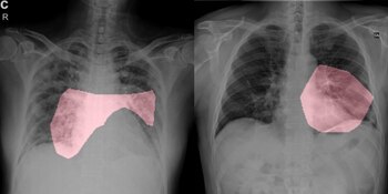 Una de las imágenes del