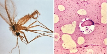 La leishmaniasis visceral impacta a