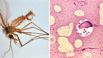La leishmaniasis visceral sigue amenazando