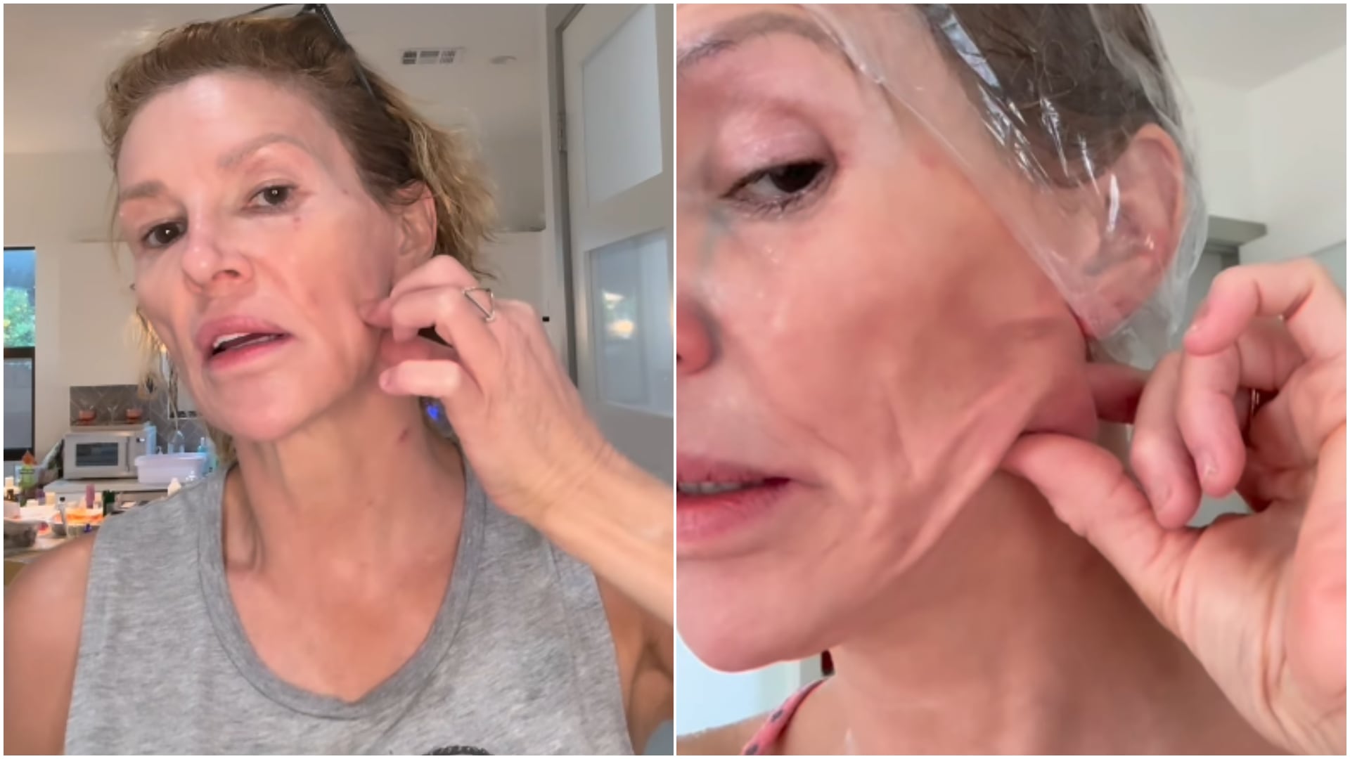 Brandi Glanville anunció que le extirparán un bulto fúngico del rostro tras años de problemas faciales sin diagnóstico (Instagram/@brandiglanville)