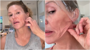 Brandi Glanville anunció que le extirparán un bulto fúngico del rostro