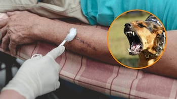 Honduras: Perro ataca a una menor de dos años y la deja hospitalizada en Copán