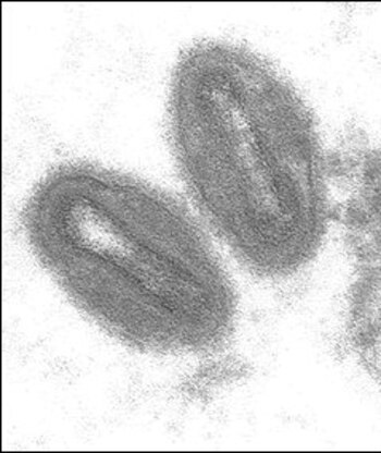 A diferencia del SARS-CoV-2, el