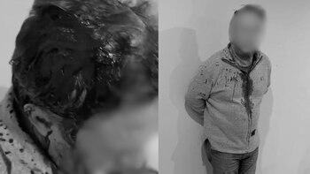 Denuncian presunto ataque a ciudadano