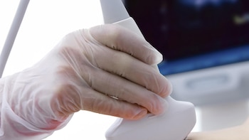 ACAI advierte de que la reforma del aborto en la Constitución podría debilitar la protección de las mujeres