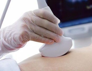 Imagen 5IDXVAL7QJATJPC7J7K42ZN3SA