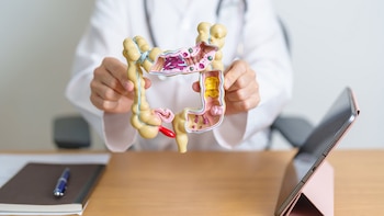 El aumento de muertes por cáncer de colon afecta más a los adultos jóvenes sin título académico