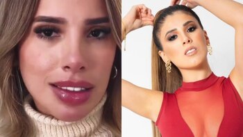 Yahaira Plasencia se habría hecho cirugía en los labios y salsera responde a apariencia de su rostro.