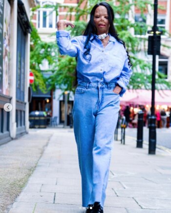 Cuatro años después del accidente