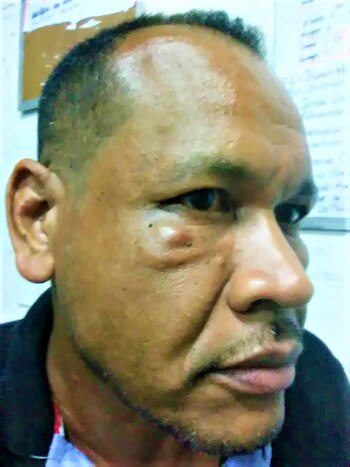 Jesús Vásquez salió golpeado del