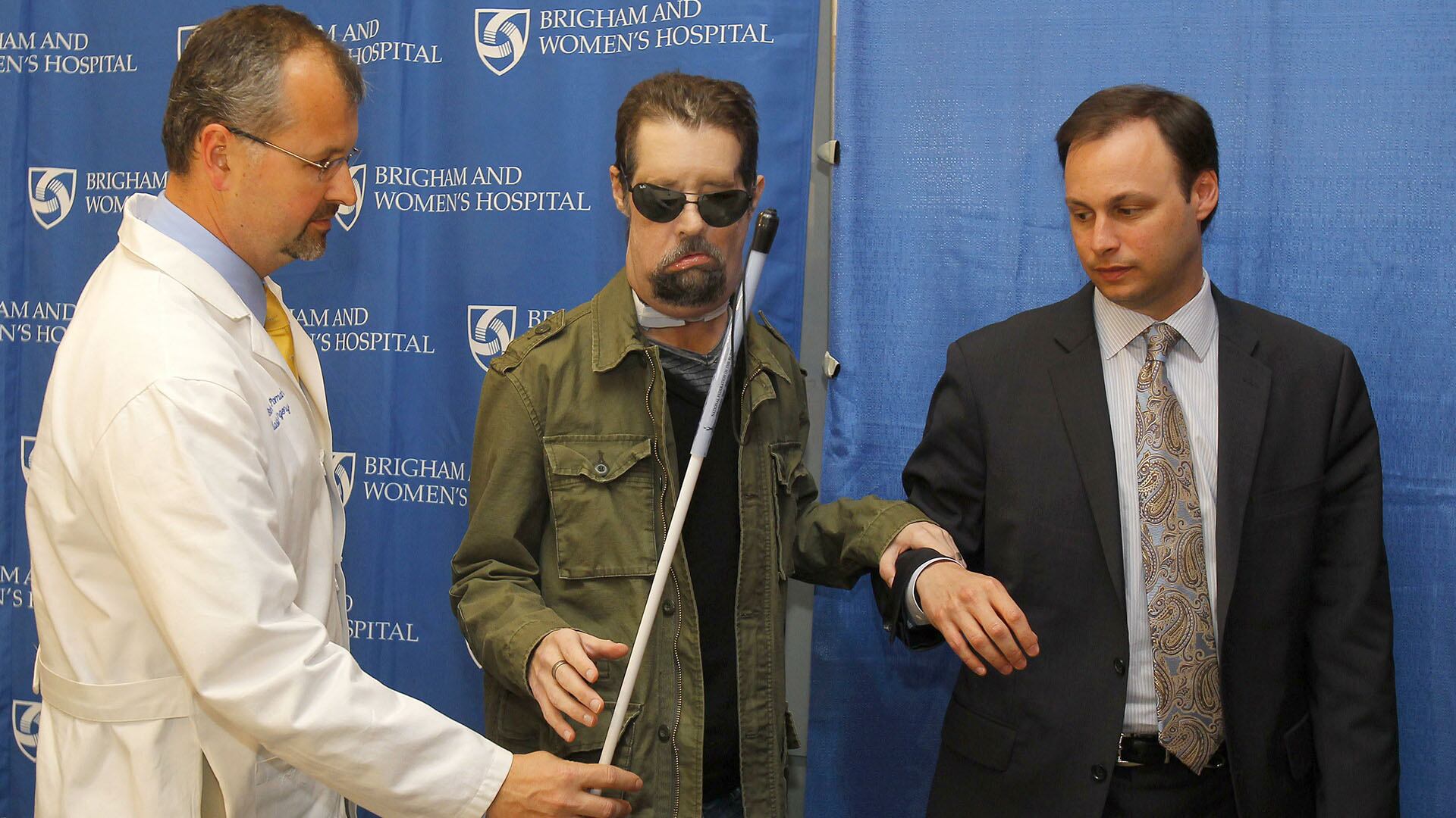 Dallas Wiens fue el primer estadounidense en someterse a un trasplante de cara total; su caso visibilizó los desafíos físicos y psicológicos que persisten años después de la cirugía (AFP)