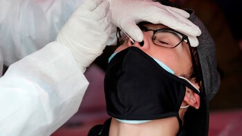 Bajan los casos de covid-19