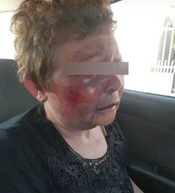 Así quedó Elma tras el