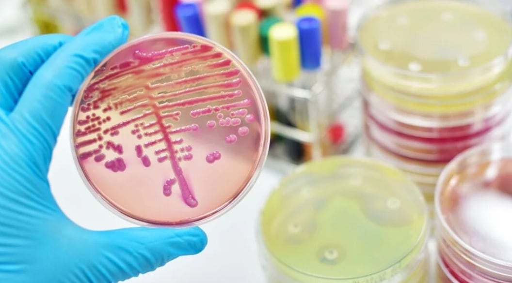 Mandan muestras a la CDMX para realizarles la la secuenciación genética de Klebsiella pneumoniae (crédito iStock)