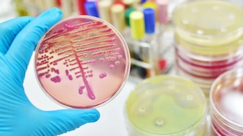 Bacteria Klebsiella pneumoniae: dónde circula