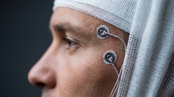 Cabeza de perfil con vendaje médico blanco. Dos electrodos con cables finos adheridos a la sien. Fondo gris oscuro desenfocado.