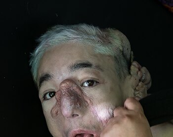 Matías Fernández Burzaco