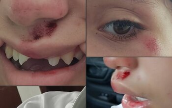 La estudiante tuvo que ser