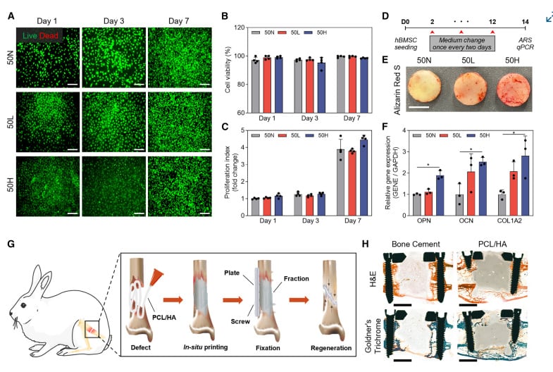 La técnica evita implantes prefabricados, reduce tiempos operatorios y elimina la necesidad de modelado previo o fabricación externa