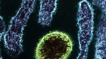 Sanidad afirma que la probabilidad