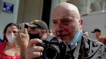 Las fuerzas de choque del