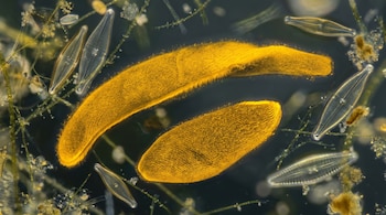 Dos microorganismos alargados de color amarillo rodeados por diatomeas transparentes y restos orgánicos sobre un fondo oscuro.