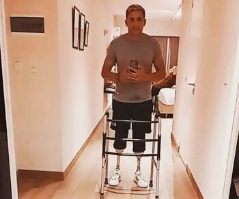 Franco LIzardo, con sus prótesis