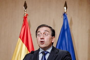 Imagen 5SLRPL4S3RB3DEERMHJZJQODJI