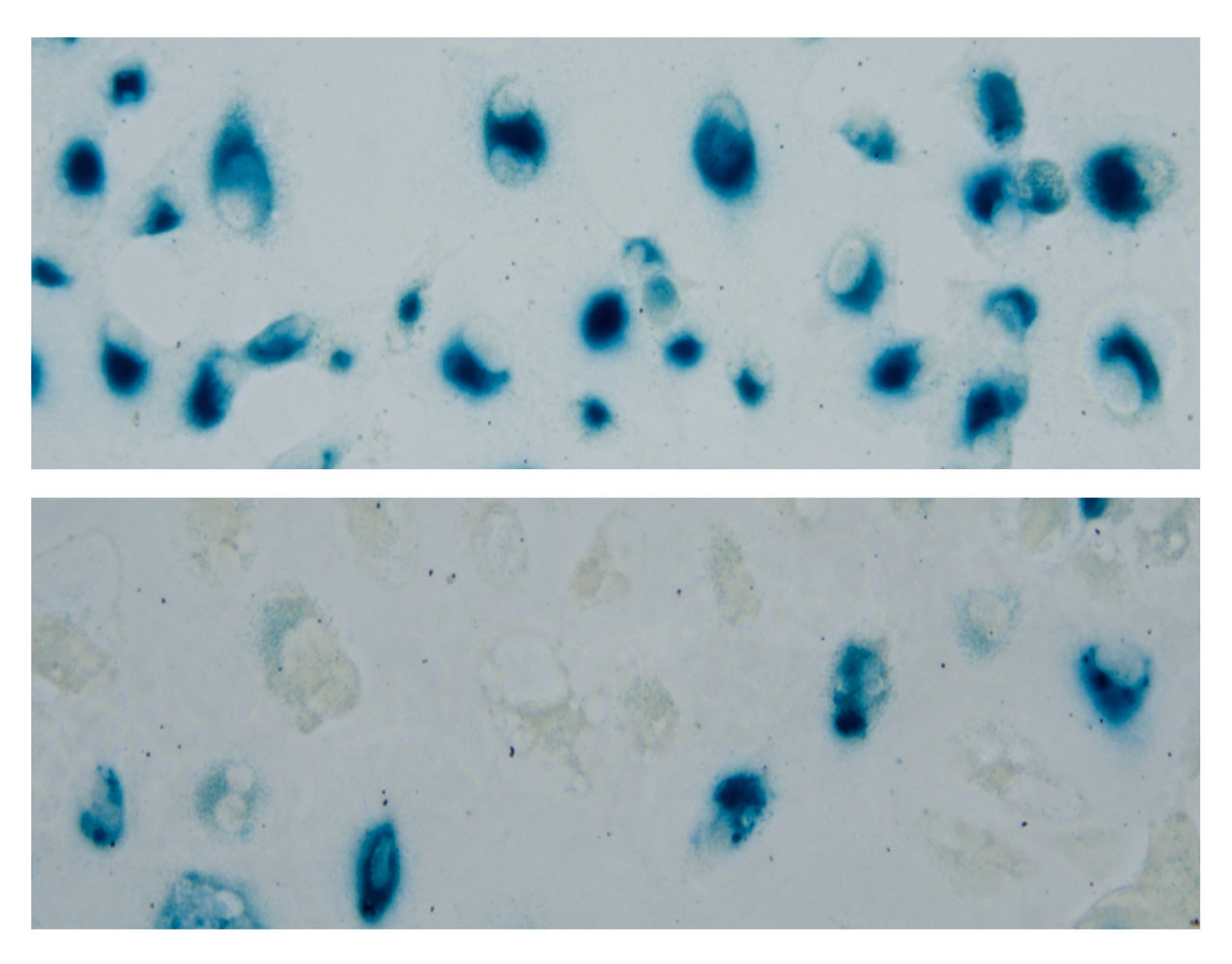 Las terapias dirigidas y la inmunoterapia cambiaron el pronóstico incluso en cánceres avanzados antes considerados intratables (AP)