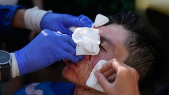 Einer Rubio habló del accidente que sufrió en la etapa 19 del Tour de Francia 2026 y que lo obligó a retirarse: “Estaba asustado por la sangre”