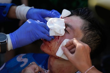 Einer Rubio accidente Tour de France