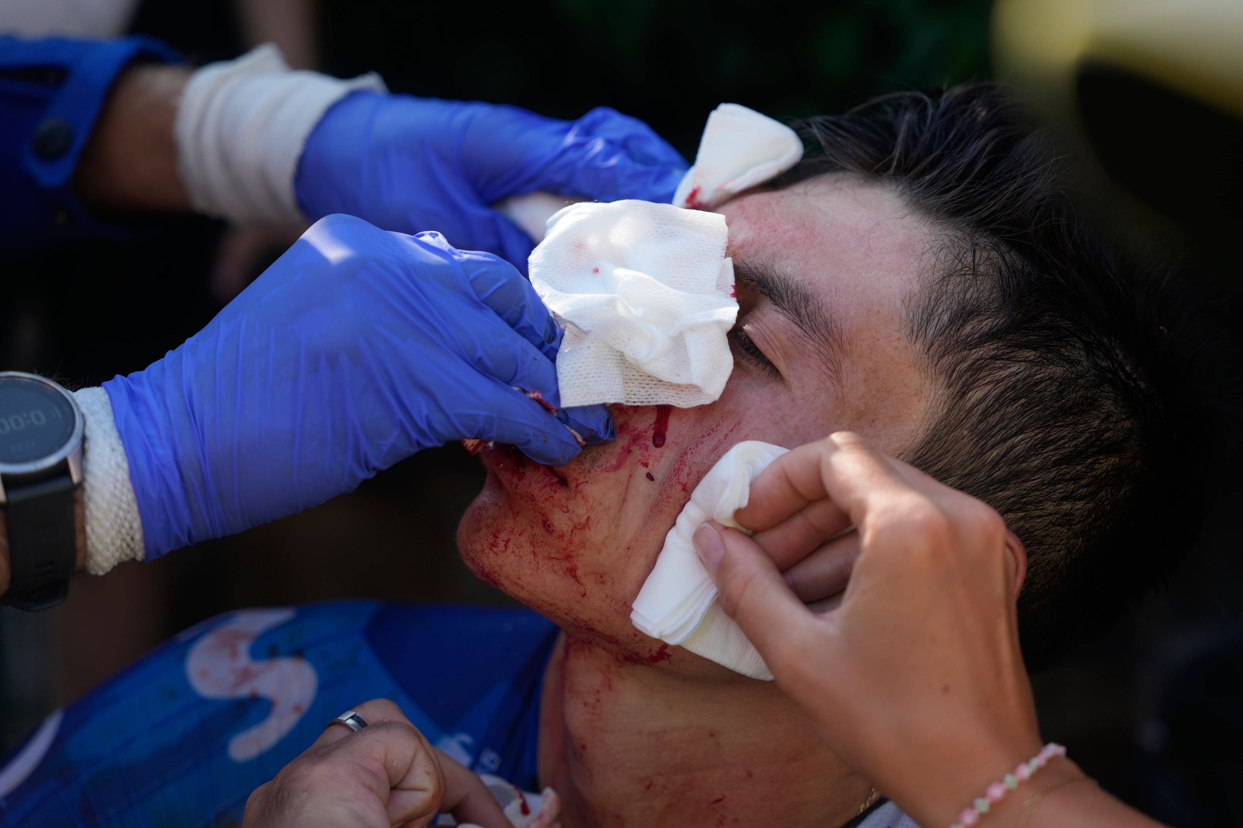 Einer Rubio abandonó el Tour de France tras su accidente (AP Photo/Mosa'ab Elshamy)