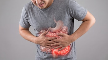 9 alimentos concentran el 90% de las alergias alimentarias en el mundo, según una experta