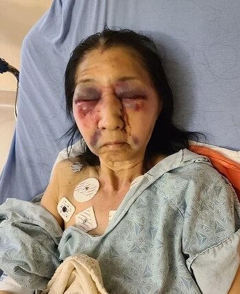 La mujer mayor resultó con